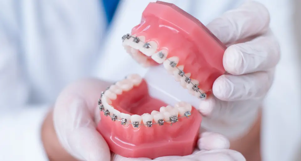 A dentist with white gloves holds a dental model with braces, showcasing orthodontic treatment. The model's teeth appear clean and well-aligned.